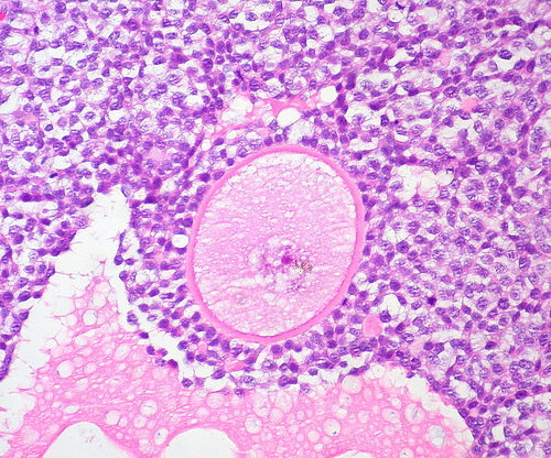 Graafian Follicle and Human Ovary